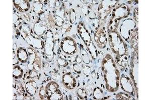 Immunohistochemical staining of paraffin-embedded liver tissue using anti-ERCC1 mouse monoclonal antibody. (ERCC1 抗体)