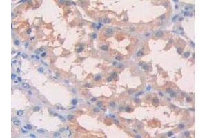 IHC-P analysis of Human Kidney Tissue, with DAB staining. (IL1R1 抗体  (AA 120-208))
