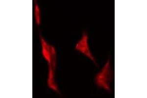 Immunofluorescence (fixed cells) (IF/ICC) image for anti-Taste Receptor, Type 2, Member 43 (TAS2R43) antibody (ABIN6265463)