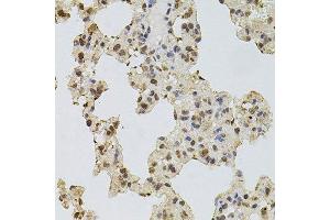 Immunohistochemistry of paraffin-embedded rat lung using EGFR antibody. (EGFR 抗体  (AA 1021-1210))