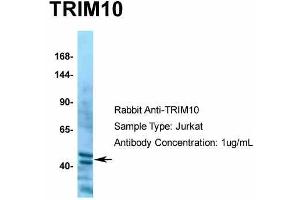 Human Jurkat; Host: Rabbit. (TRIM10 抗体  (C-Term))
