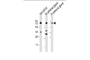 All lanes : Anti-DBH Antibody (N-term P42) at 1:2000 dilution Lane 1: SH-SY5Y whole cell lysate Lane 2: mouse adrenal gland lysate Lane 3: rat adrenal gland lysate Lysates/proteins at 20 μg per lane. (DBH 抗体  (N-Term))