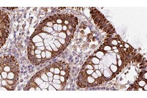 ABIN6272882 at 1/100 staining Mouse colon tissue by IHC-P. (CISD1 抗体  (Internal Region))