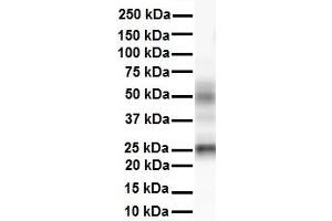 Western Blotting (WB) image for anti-Transmembrane Emp24 Protein Transport Domain Containing 1 (TMED1) (N-Term) antibody (ABIN2782743)