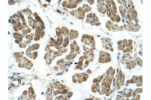 RHOT1 antibody was used for immunohistochemistry at a concentration of 4-8 ug/ml to stain Skeletal muscle cells (arrows) in Human Muscle. (RHOT1 抗体  (N-Term))