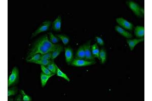 Immunofluorescent analysis of HepG2 cells using ABIN7174961 at dilution of 1:100 and Alexa Fluor 488-congugated AffiniPure Goat Anti-Rabbit IgG(H+L) (Myosin VIIA 抗体  (AA 838-968))