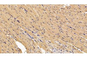 Immunohistochemistry (IHC) image for anti-Superoxide Dismutase 1, Soluble (SOD1) (AA 2-154) antibody (ABIN7429214)