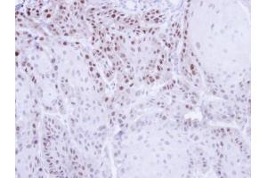 IHC-P Image Immunohistochemical analysis of paraffin-embedded Cal27 Xenograft , using CSE1L, antibody at 1:500 dilution. (Exportin 2 抗体  (Center))