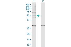 Western Blot analysis of WASL expression in transfected 293T cell line by WASL MaxPab polyclonal antibody. (Neural Wiskott-Aldrich syndrome protein (WASL) (AA 1-505) 抗体)