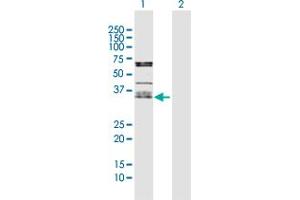 Western Blot analysis of OLR1 expression in transfected 293T cell line by OLR1 MaxPab polyclonal antibody. (OLR1 抗体  (AA 1-273))