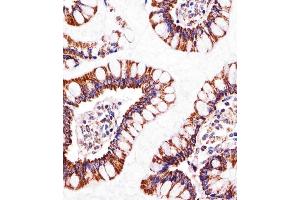 Immunohistochemical analysis of paraffin-embedded H. (ATP5B 抗体  (AA 135-163))