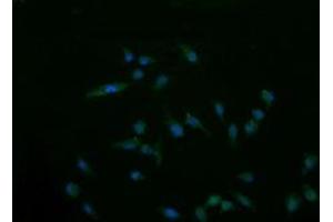 Image no. 1 for anti-Cancer/testis Antigen 1B (CTAG1B) antibody (ABIN1499903) (CTAG1B 抗体)
