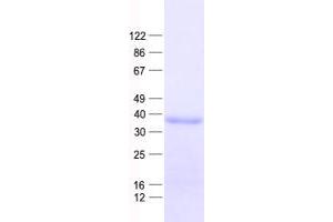 Western Blotting (WB) image for Paired Box 4 (PAX4) protein (His tag) (ABIN2728316)