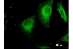 Immunofluorescence of monoclonal antibody to STAB1 on HeLa cell. (Stabilin 1 抗体  (AA 1804-1902))