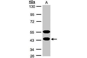 WB Image Sample(30 ug whole cell lysate) A:MOLT4 , 10% SDS PAGE antibody diluted at 1:1000 (CABS1 抗体  (Center))