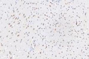 Immunohistochemistry (Paraffin-embedded Sections) (IHC (p)) image for anti-Ring Finger Protein 1 (RING1) antibody (ABIN7075467)