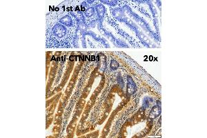 Immunohistochemistry (IHC) image for anti-Catenin, beta (CATNB) (C-Term) antibody (ABIN6254224)