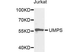 Western blot analysis of extracts of Jurkat cells, using UMPS antibody (ABIN5973202) at 1/1000 dilution. (UMPS 抗体)