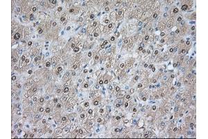 Immunohistochemical staining of paraffin-embedded Human prostate tissue using anti-PDE4A mouse monoclonal antibody. (PDE4A 抗体)