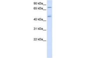 Image no. 1 for anti-DEAD (Asp-Glu-Ala-Asp) Box Polypeptide 1 (DDX1) (AA 36-85) antibody (ABIN6740488) (DDX1 抗体  (AA 36-85))