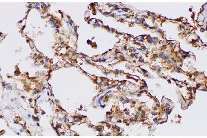 Immunohistochemistry of paraffin-embedded Human lung using FGA Polycloanl Antibody at dilution of 1:100 (FGA 抗体)