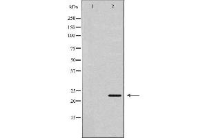 Western blot analysis of extracts of MCF7, using BAK1 antibody. (BAK1 抗体  (N-Term))