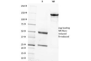 SDS-PAGE Analysis Purified FSH beta Mouse Monoclonal Antibody (FSHb/1062). (FSHB 抗体)