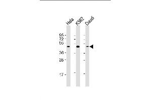 Lane 1: HeLa Cell lysates, Lane 2: K562 Cell lysates, Lane 3: Daudi Cell lysates, probed with PLIN3 (1651CT157. (PLIN3 抗体)