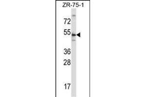 TERF2 Antibody (Center) (ABIN657781 and ABIN2846755) western blot analysis in ZR-75-1 cell line lysates (35 μg/lane). (TRF2 抗体  (AA 308-337))