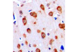 Immunohistochemistry (IHC) image for anti-Activin A Receptor Type II-Like 1 (ACVRL1) (Center) antibody (ABIN7294846)