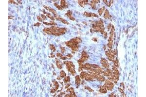 Formalin-fixed, paraffin-embedded rat uterus stained with Calponin antibody (CNN1/832 + CALP). (Calponin 抗体)