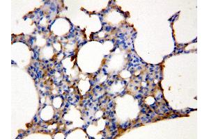 Anti-Aquaporin 5 antibody, IHC(P) IHC(P): Rat Lung Tissue Lysate (Aquaporin 5 抗体  (C-Term))