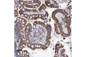 Immunohistochemical staining of human colon with EFR3A polyclonal antibody  shows srrong cytoplasmic positivity with granular pattern in glandular cells at 1:20-1:50 dilution. (EFR3A 抗体)