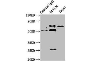 Immunoprecipitating MSLN in HepG2 whole cell lysate Lane 1: Rabbit control IgG instead of ABIN7159428 in HepG2 whole cell lysate. (Mesothelin 抗体  (AA 37-598))