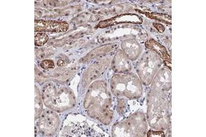 Immunohistochemical staining of human kidney with TSSC4 polyclonal antibody  shows strong cytoplasmic and moderate nuclear positivity in subsets of tubules at 1:1000-1:2500 dilution. (TSSC4 抗体)