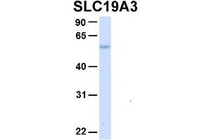 Host:  Rabbit  Target Name:  SLC19A3  Sample Type:  Human Fetal Liver  Antibody Dilution:  1. (SLC19A3 抗体  (Middle Region))