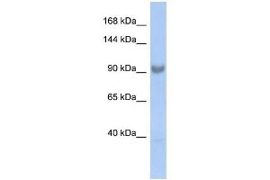 WB Suggested Anti-SART3 Antibody Titration:  0. (SART3 抗体  (Middle Region))