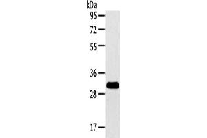 Gel: 8 % SDS-PAGE,Lysate: 40 μg,Primary antibody: ABIN7192139(RalA Antibody) at dilution 1/200 dilution,Secondary antibody: Goat anti rabbit IgG at 1/8000 dilution,Exposure time: 2 minutes (rala 抗体)