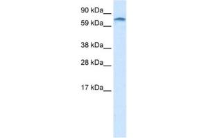 Western Blotting (WB) image for anti-Zinc Finger Protein 84 (ZNF84) antibody (ABIN2461187) (ZNF84 抗体)