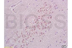 Formalin-fixed and paraffin embedded rat brain tissue labeled with Anti-Integrin beta 1/CD29 Polyclonal Antibody (ABIN669216), Unconjugated at 1:200, followed by conjugation to the secondary antibody and DAB staining (ITGB1 抗体  (AA 25-100))