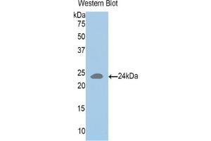 Detection of recombinant HLA-DRA using Polyclonal Antibody to HLA Class II Histocompatibility Antigen, DR Alpha Chain (HLA-DRA) (HLA-DRA 抗体  (AA 26-216))