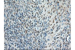 Immunohistochemical staining of paraffin-embedded colon using anti-Trim33 (ABIN2452535) mouse monoclonal antibody. (TRIM33 抗体  (AA 887-1046))