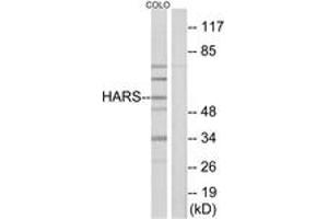 Western blot analysis of extracts from COLO cells, using HARS Antibody. (HARS1/Jo-1 抗体  (AA 460-509))
