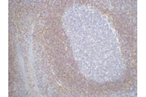 Immunohistochemistry (IHC) staining of Human Tonsil Tissue paraffin-embedded, diluted at 1:200. (Bcl-2 抗体)