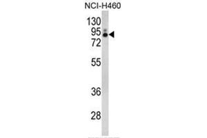 Western blot analysis of PLA2G4A Antibody (Center) in NCI-H460 cell line lysates (35ug/lane). (PLA2G4A 抗体  (Middle Region))