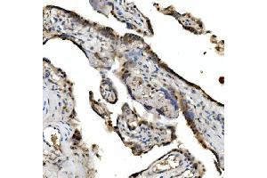 IHC analysis of VPRBP/DCAF1 using anti-VPRBP/DCAF1 antibody (ABIN7599063). (DDB1 and CUL4-Associated Factor 1 (DCAF1) (AA 1-195) 抗体)