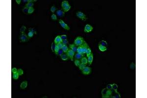 Immunofluorescent analysis of PC-3 cells using ABIN7158932 at dilution of 1:100 and Alexa Fluor 488-congugated AffiniPure Goat Anti-Rabbit IgG(H+L) (PRNP 抗体  (AA 23-64))