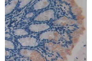 Detection of TTK in Mouse Colon Tissue using Polyclonal Antibody to TTK Protein Kinase (TTK) (Mps1 抗体  (AA 527-786))