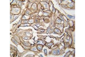 Immunohistochemistry (IHC) image for anti-HRas proto-oncogene, GTPase (HRAS) (AA 104-128) antibody (ABIN3029525)