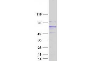 Validation with Western Blot